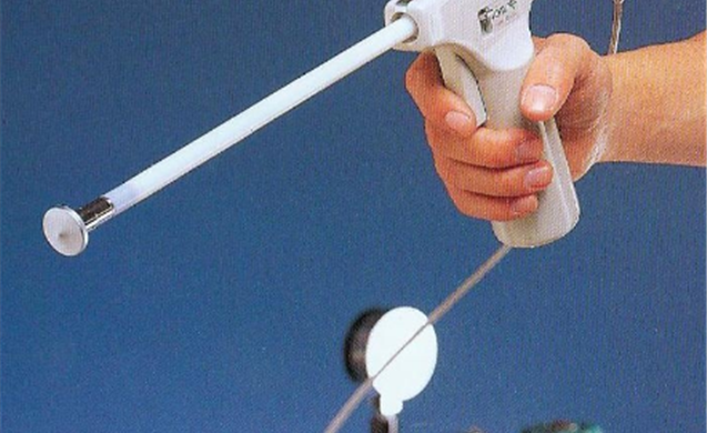 Video kỹ thuật áp lạnh cổ tử cung (Cryotherapy) trong điều trị tổn thương cổ tử cung